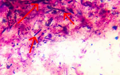 Antibiotikum, vagy probiotikum?