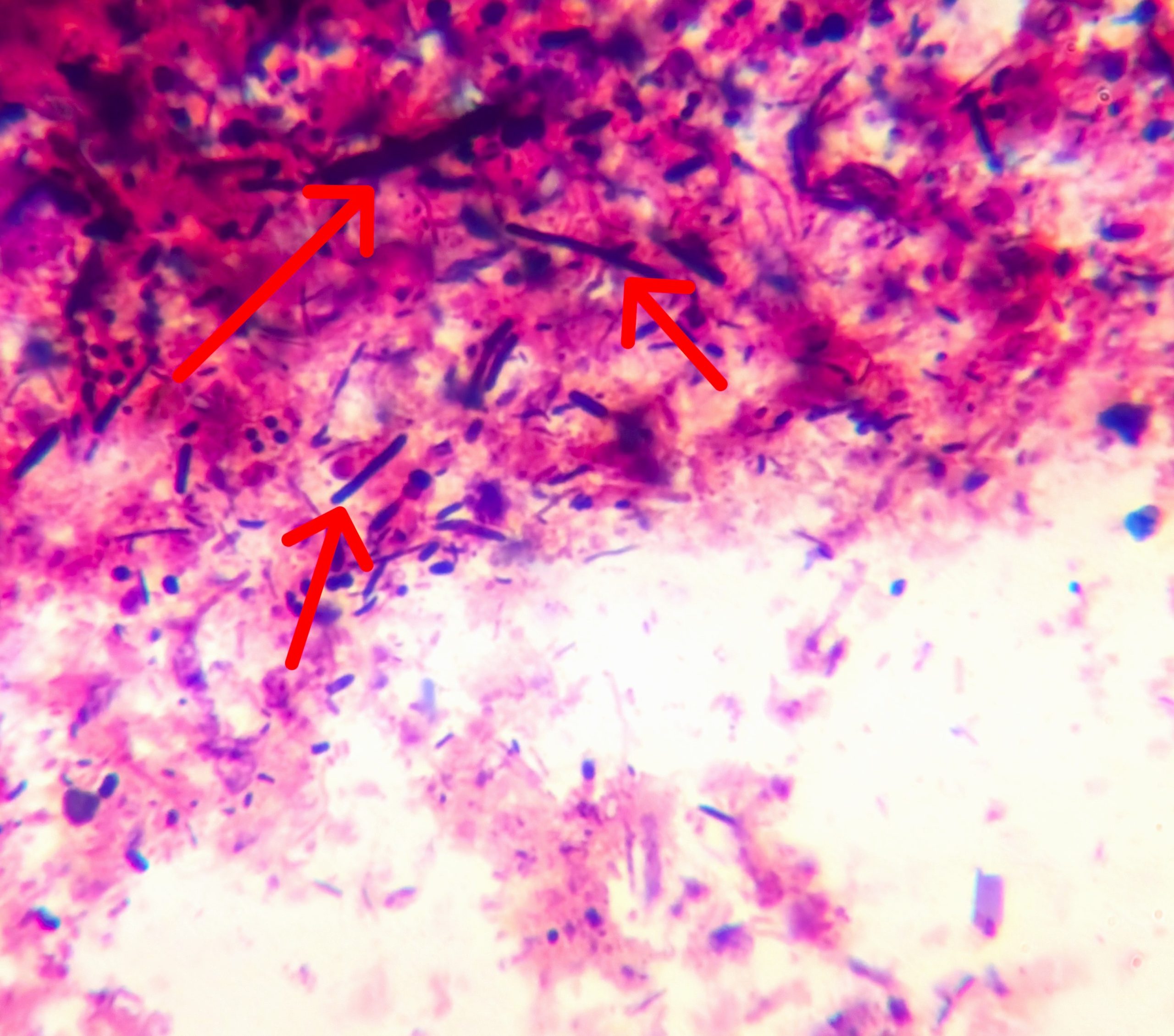 Antibiotikum, vagy probiotikum?